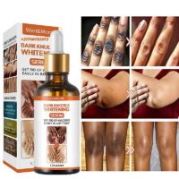 Dark Knuckle Whitening Serum In Lerici Comune in Italy Call ☏ +2771 073 2372 Get Rid Of Tattoos And 