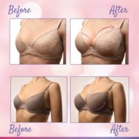 Breast Enlargement Products In Al-Jafr City in Jordan Call ☏ +27710732372 Breast Lifting Cream And P