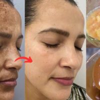 +27710732372 Skin Bleaching Oil In South Africa, Skin Whitening Products In Heath Town in Massachuse